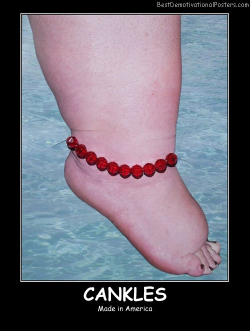 Cankles funny Demotivational Posters